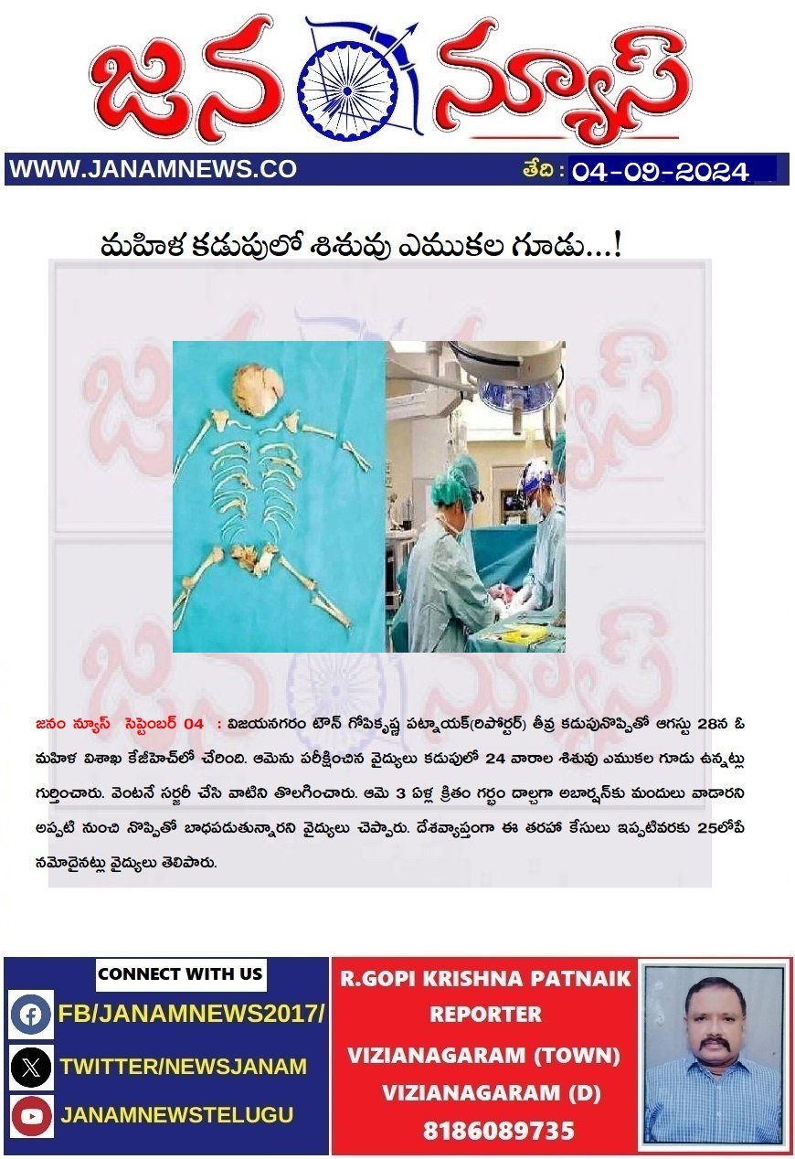 మహిళ కడుపులో శిశువు ఎముకల గూడు...!